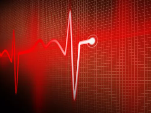 Az FDA hangsúlyozottan figyelmeztet az NSAID-ok kardiális és stroke-kockázatára