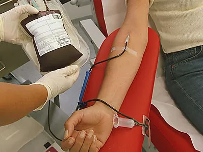 „Érvágással” kezelhető a hipertónia