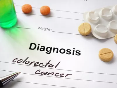 Az antibiotikumok és a béldaganatok kapcsolata