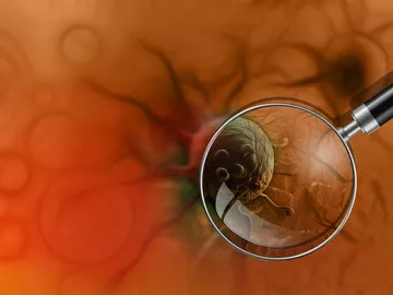 A colorectalis carcinoma terápiájának újdonságai