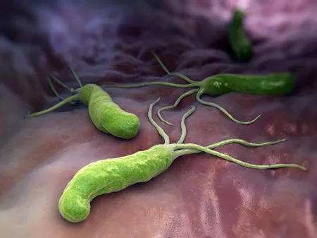 A Helicobacter pylori eradikációja 2017-ben