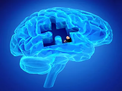 Mégsem az agyból indul ki az Alzheimer-kór?
