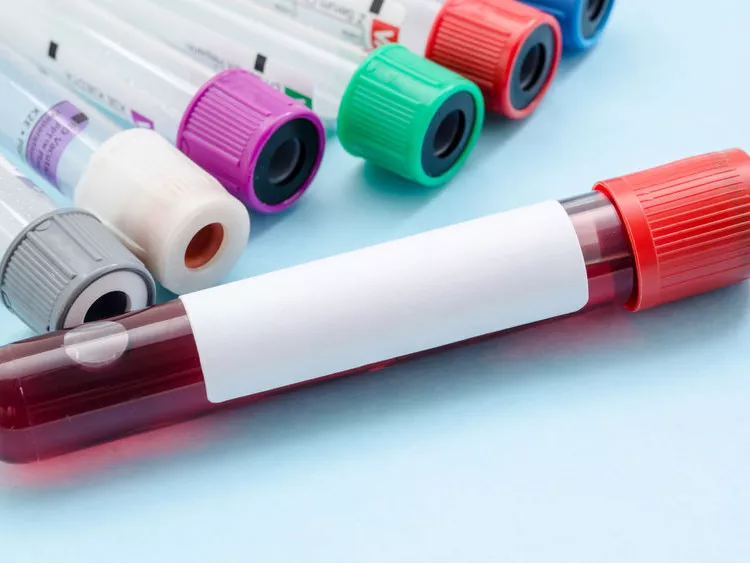 QuickGel: újítás a T-sejtek kinyerésének technológiájában