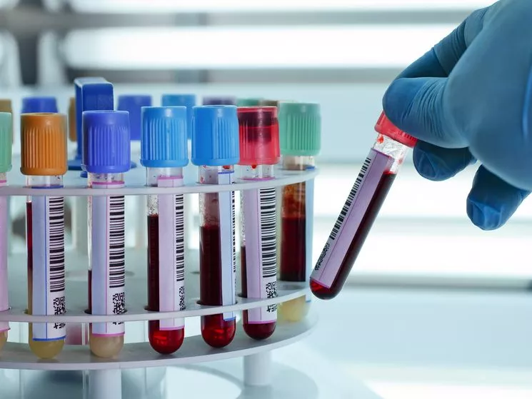 Az OTC-gyógyszerek befolyásolhatják a laborparamétereket