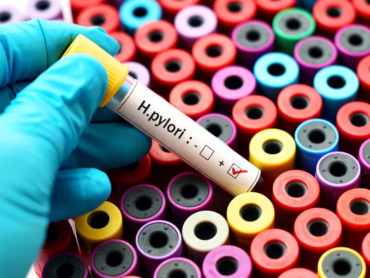 H. pylori ellen is véd az új rákgyógyszer-jelölt