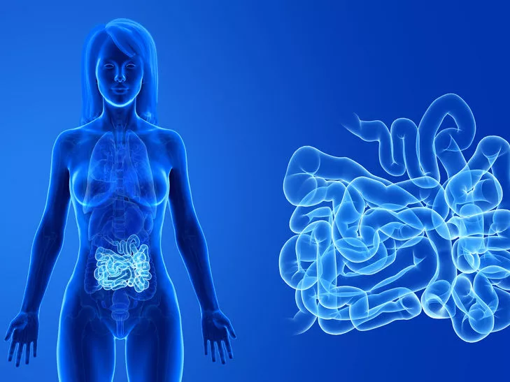 Mezenchimális őssejtes gyógyszer Crohn-betegeknek