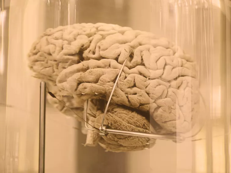 Chaperone kezelés segíthet Alzheimer-kór esetén