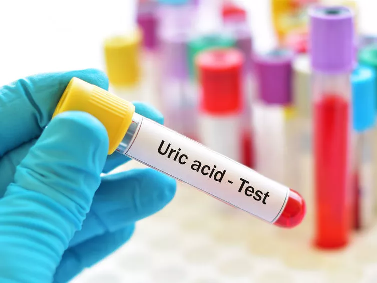 Az SGLT-2-gátlók védhetik a cukorbetegeket a köszvénytől