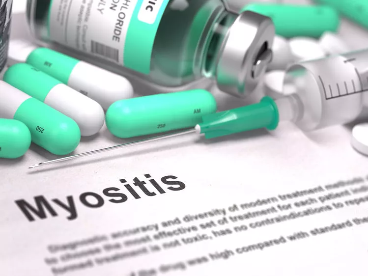 Idiopathiás inflammatorikus myopathiák