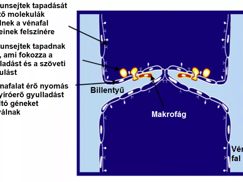 Mikor melyik vénaerősítő tablettát ajánljuk a betegnek?