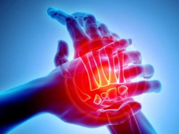 Ízületi fájdalom télen? Tanácsok reumatoid arthritisben szenvedőknek