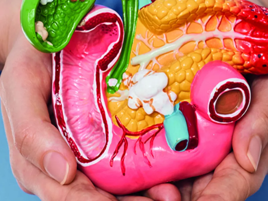 Pancreasenzim-pótló kezelések – kiknek, hogyan, miként?
