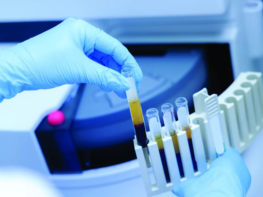 Zöld utat kapott az Európai Bizottságtól a hazai fejlesztésű biomarker-teszt